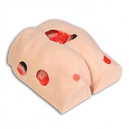 Seymour II Decubitus Wound Care Model product image