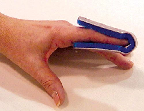 Fold Over Finger Splint Medium Bulk  PK/6 Non-Retail product image